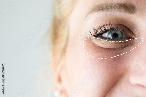 Woman showing eye bags under her blue eye, indicating aging skin