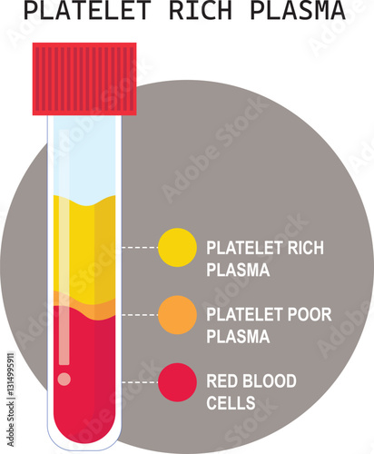 A centrifuge is a laboratory device used to isolate blood components, purify cells, separate plasma or serum based on density by spinning samples at high speed. 