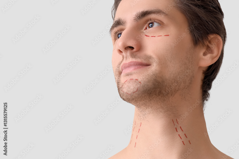 Obraz premium Young man with marked face on light background, closeup. Plastic surgery concept