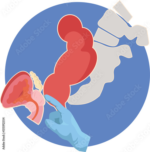 digital rectal examination for diagnosis of bph or prostatic cancer 