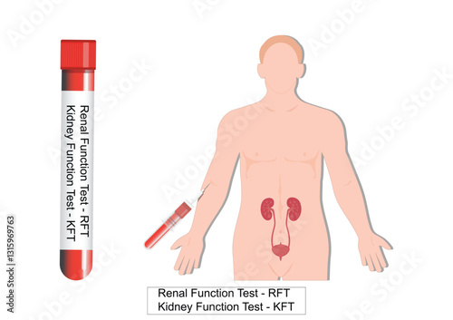 Renal function tests(Kidney function tests)