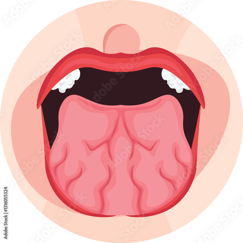 tongue fissure due to dry tongue