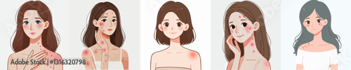 vector collection of a person with allergies and redness