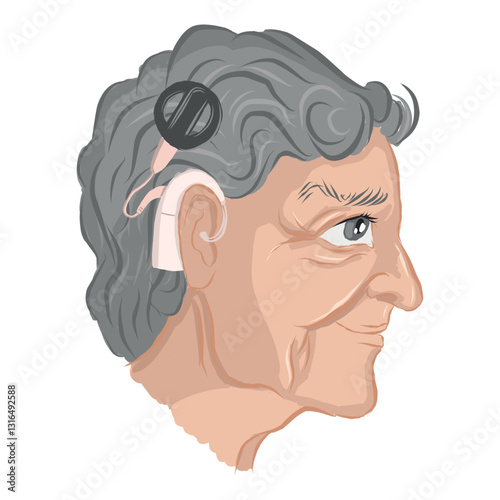 Elderly woman in profile with cochlear implant. Vector illustration