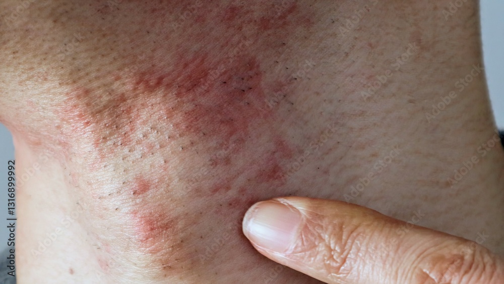 Fototapeta premium 脱毛後の肌の炎症を指差す男性