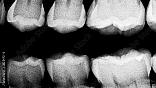 Human teeth x-ray or ct scan. Human black white body parts of jaw, teeth. Scary Halloween background.