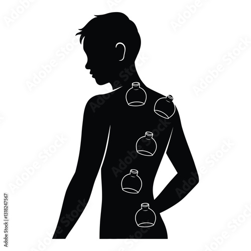 Cupping Therapy Marks Silhouette, Vector, Icon, Logo, White Background.