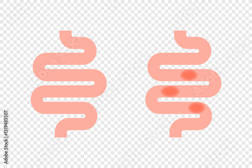 Intestines and bowel ache. Colitis vector icon
