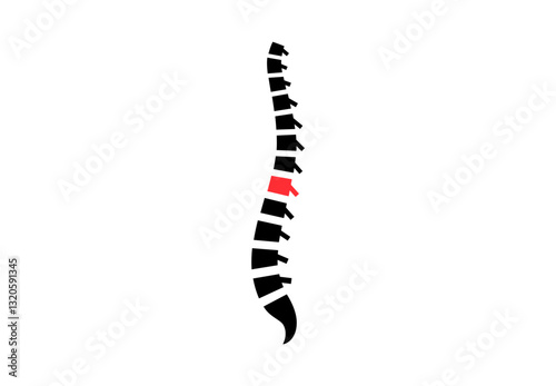 Spine disease pain