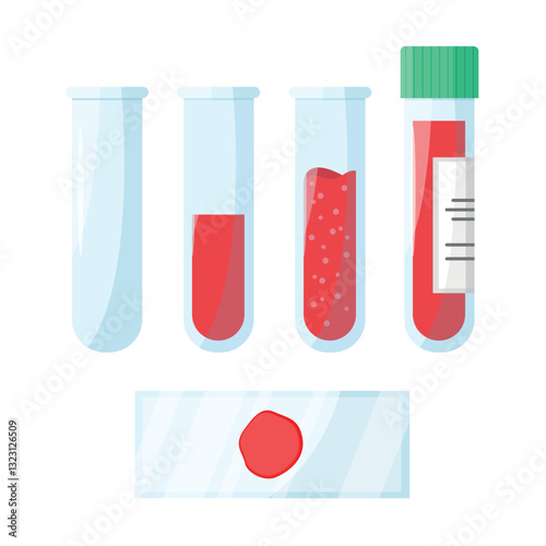 Set of test tubes with blood sample. Blood analysis. Biochemical, laboratory analysis.