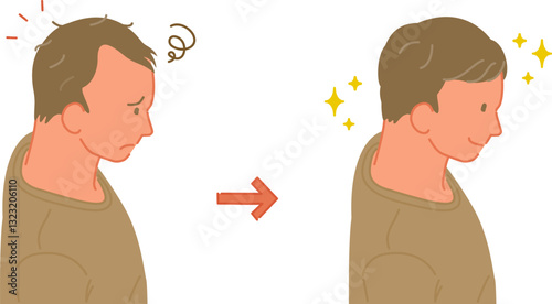 薄毛の男性の治療前と治療後のイラストセット（俯瞰）