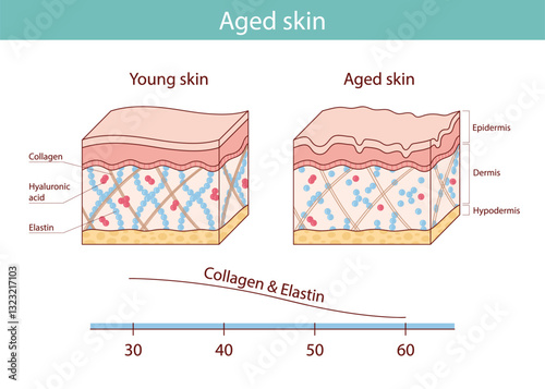 vector illustration of the skin aging process.