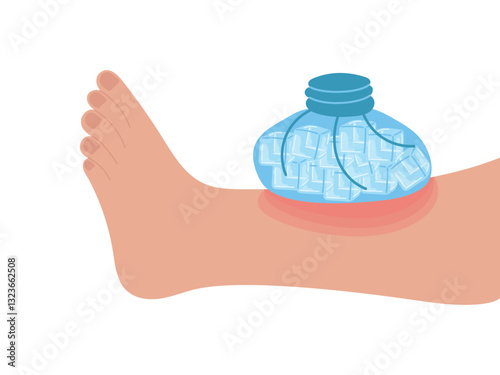 Ice pack applied to leg with bruise, wound. Vector of first aid for injuries, ice cubes
