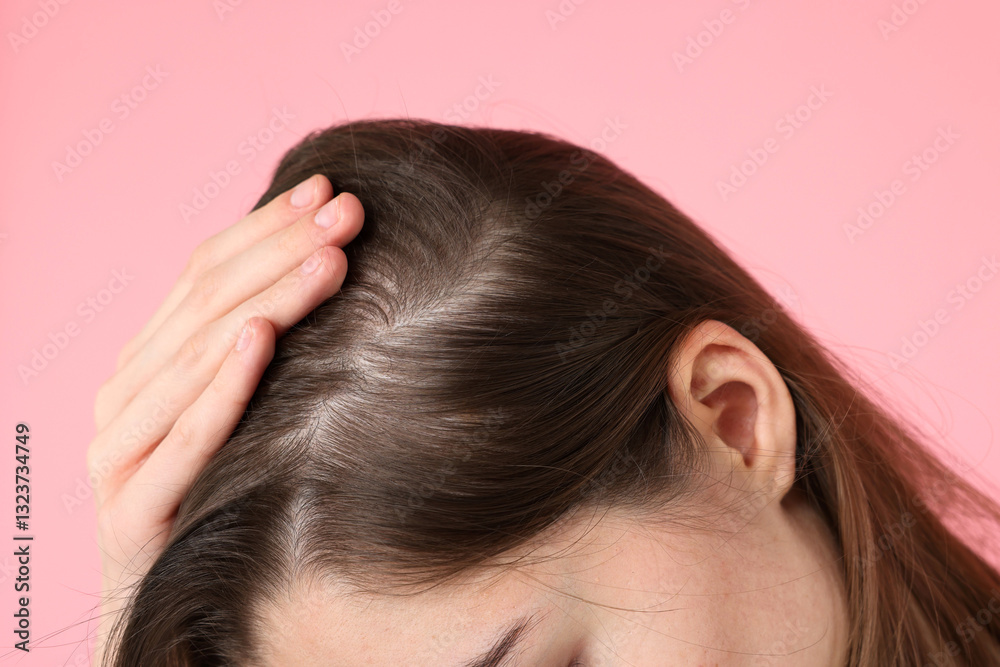 Fototapeta premium Girl with hair loss problem on pink background, closeup