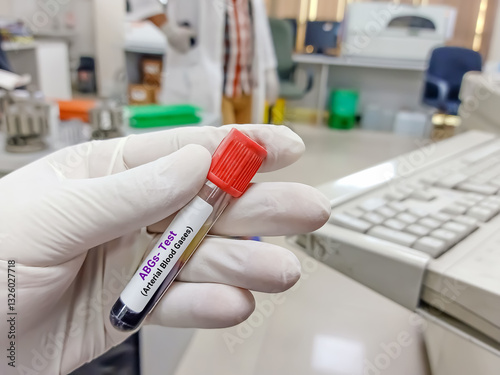 Scientist hold blood sample for Arterial blood gases test. Healthcare and medical test concept.