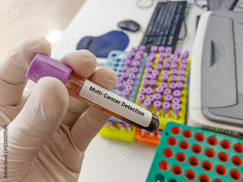 Scientist hold blood sample for Multi cancer Detection (MCED) test. Healthcare and medical test concept.