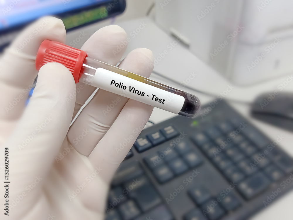 Scientist hold blood sample for Polio Virus test. Healthcare and medical test concept. Scientist hold blood sample for Polio Virus test. Healthcare and medical test concept.