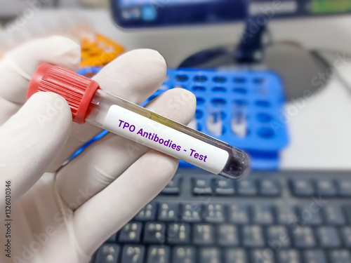 Scientist hold blood sample for TPO Antibodies test. Healthcare and medical test concept.