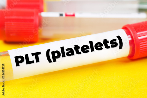 PLT (Platelets) text meaning analysis