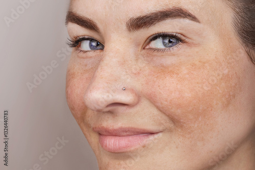 Close up caucasian woman's face with freckles or age spots. Age spots on the face, melasma