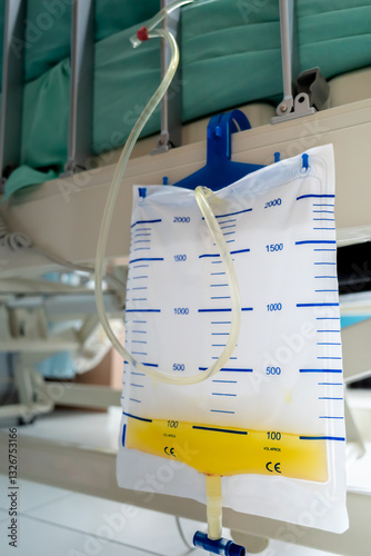 Urinary catheter measurement bag hung on the side of patient bed in hospital ward