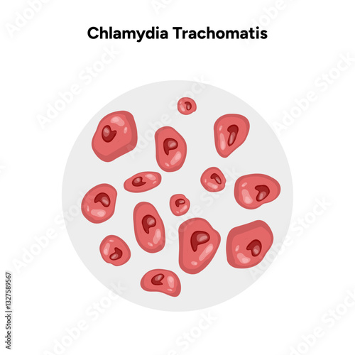 Chlamydia Trachomatis. Woman’s and man's reproductive system infections. Medical disease 