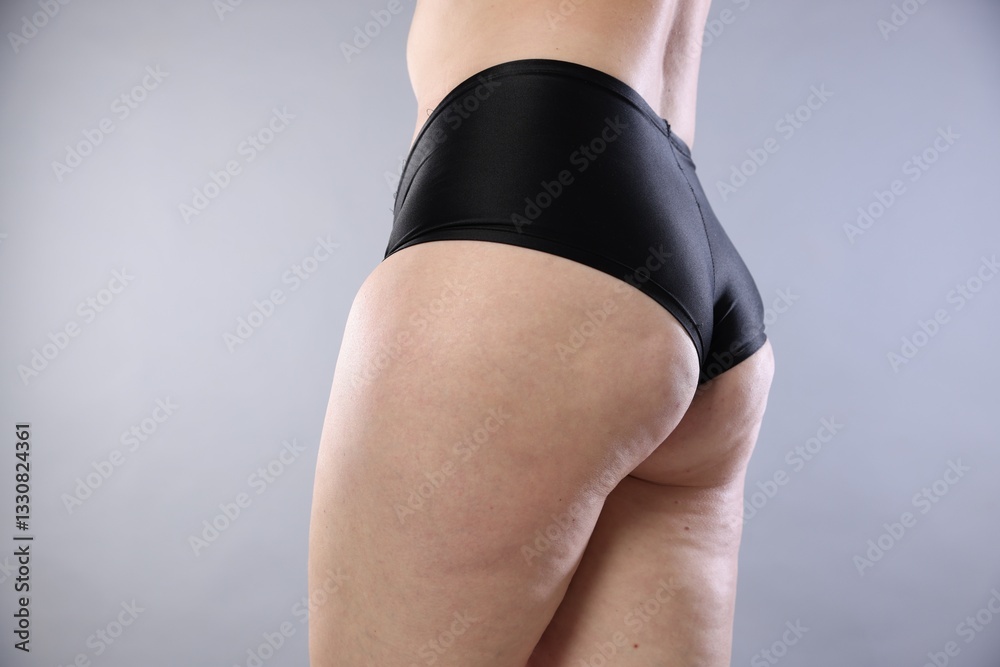Fototapeta premium Woman with cellulite on light grey background, closeup