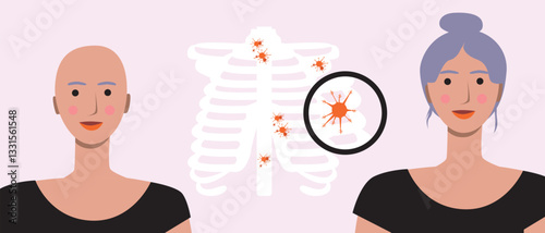 Cancer patients silhouettes and cancer ribbon, silhouette vector stock illustration with unidentifiable people together as a template with space for text or copy space