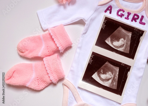 Cutie baby cloth with 2d ultrasound baby. pregnancy annoucement concept. photo