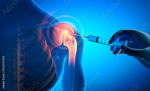 Anatomy human shoulder joint Osteoarthritis treatment, drug injection - 3d illustration
