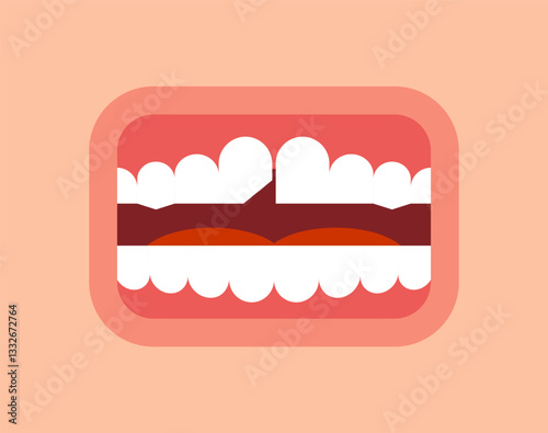 Chipped tooth in mouth. Broken tooth.