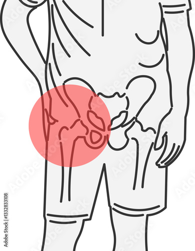 Man with Pelvic Pain Hip Dysplasia and Osteoarthritis at Home