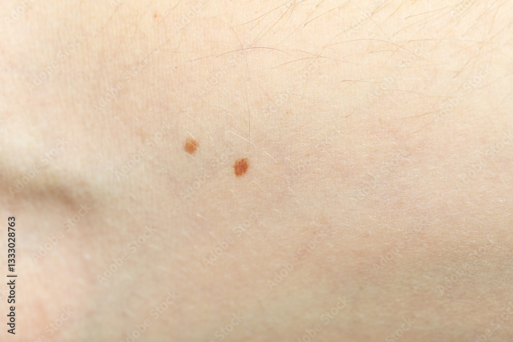 Texture of normal skin as background, closeup Texture of normal skin as background, closeup