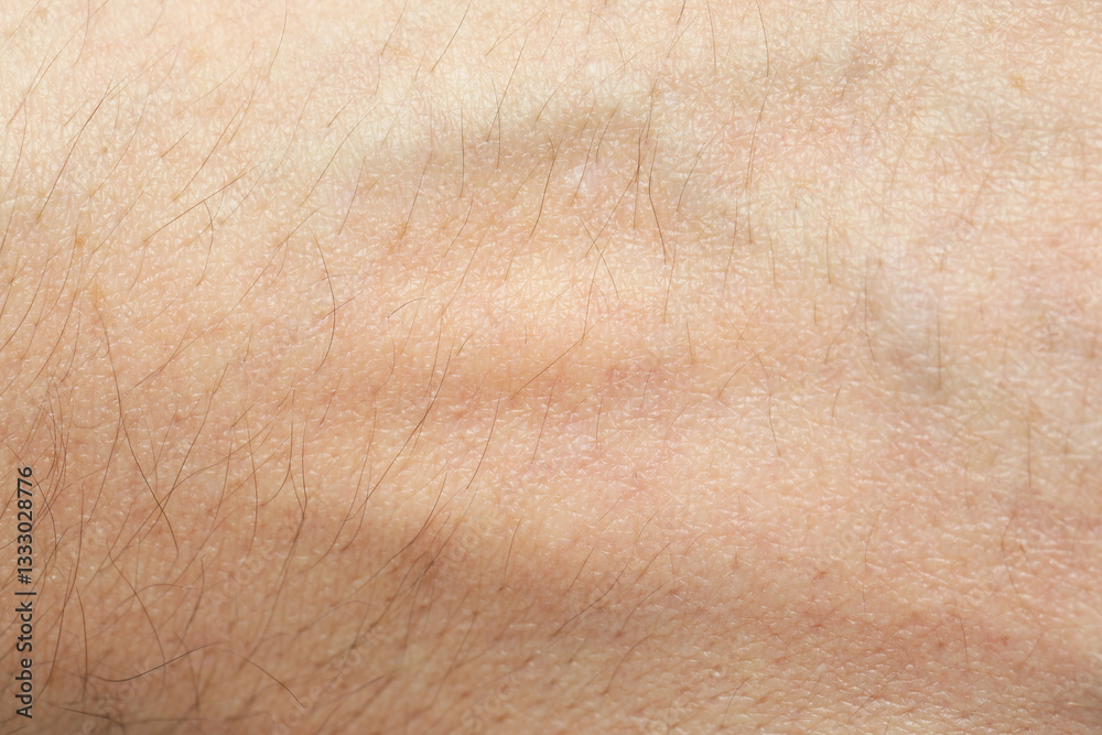 Texture of normal skin as background, closeup Texture of normal skin as background, closeup