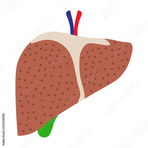 fatty liver disease