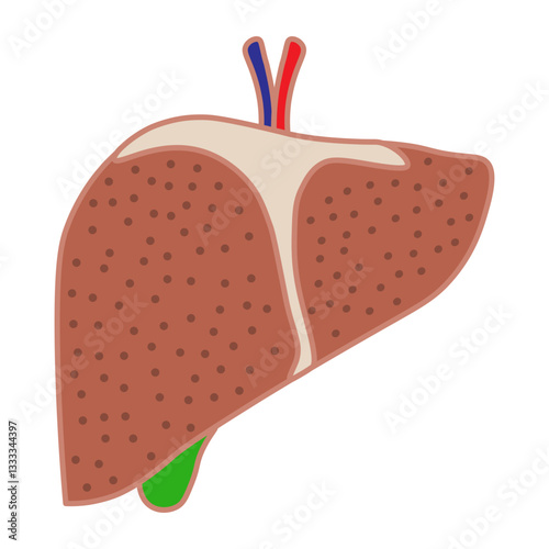 fatty liver disease