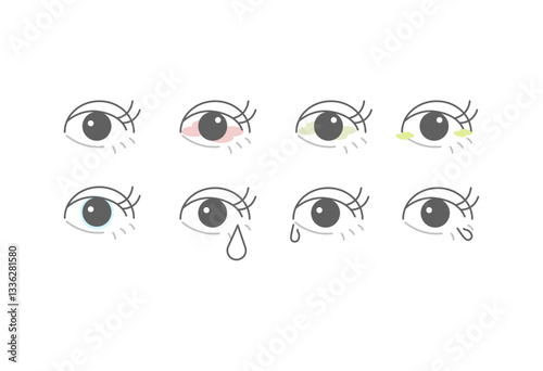 目の病気, 目の症状, 目の不調, 充血, 目のかゆみ, 目の腫れ, 花粉症, アレルギー, ドライアイ, 涙目, 目の痛み, 目の炎症, 目の違和感, 目の病気イラスト, 目の疲れ, 目の乾燥, 涙, アレルギー反応, 目のかすみ, 目のかゆみイラスト, 目の腫れイラスト, 充血イラスト, 目の充血, 目の健康, 目の疾患, 目の症状一覧, 目の不快感, 目の悩み, 目の問題, 目薬, 目のケア