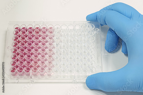 Hand with scientist's glove holding a multiwell plate for ELISA test. Diagnostic tests in the laboratory.