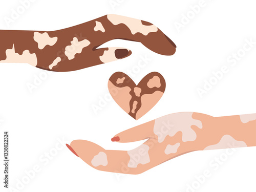 Two vitiligo hands with suffering from leprosy disease holding heart show care and support. vector illustration