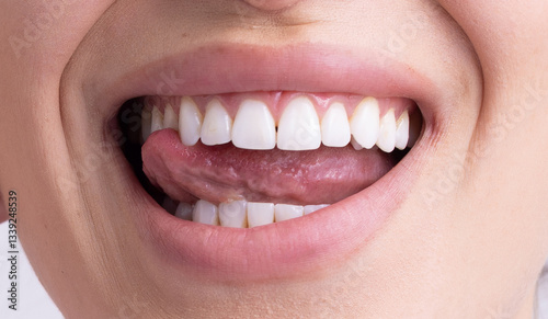 A close-up of a smiling mouth with clean, white teeth and a pink tongue playfully sticking out. The lips are slightly parted, revealing a set of straight teeth. The skin appears smooth and young