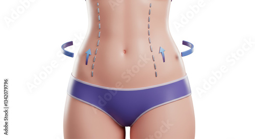 Isolated Female Torso with Contouring Arrows - Conceptual Illustration of Cosmetic Surgery and Body Transformation