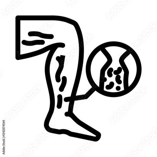 deep vein thrombosis cardiology disease line icon vector illustration