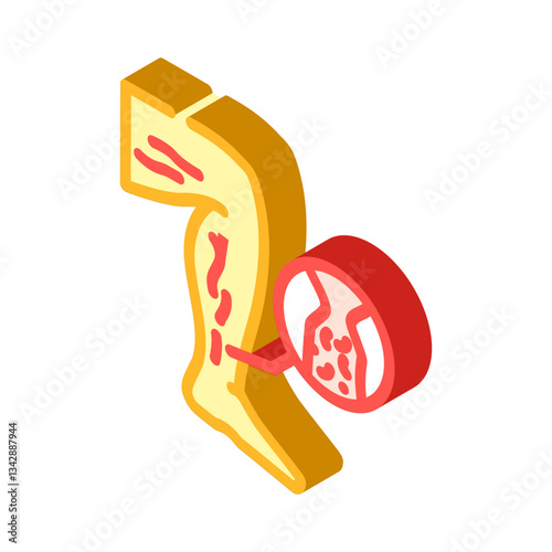 deep vein thrombosis cardiology disease isometric icon vector illustration