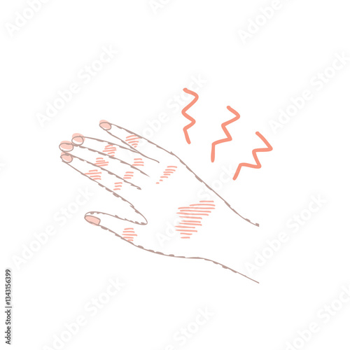 ハンドケア トラブルのある手