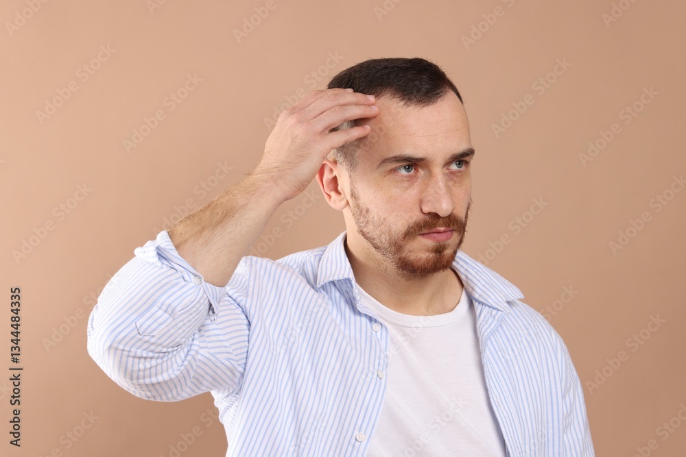 Baldness problem. Man with receding hairline on beige background Baldness problem. Man with receding hairline on beige background