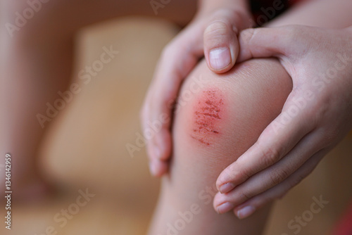 Detailed view of a healing scrape on a child's knee, captured outdoors after playtime. 
