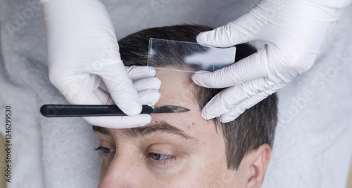 A dermatologist takes a skin scraping test for demodicosis and dermatitis, fungal infection. Close-up of a male patient's face at a doctor's appointment