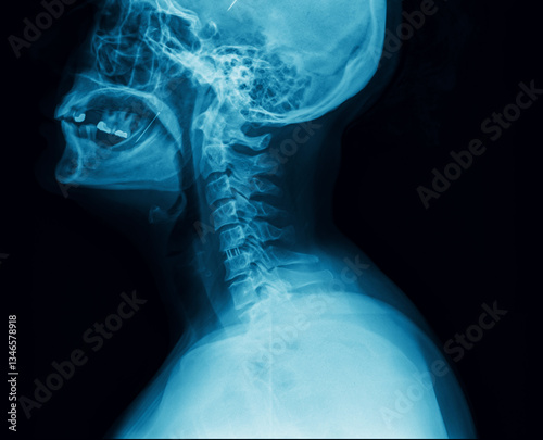 Lateral X-ray of skull and cervical spine with medical imaging detail. Head and neck Xray film with visible bone structure. Diagnostics, internal anatomy and health assessment concept