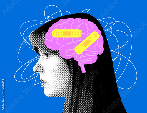 Modern collage with female head and brain covered with plaster bandage. Concept of mental health, dementia, headache. Head trauma, amnesia illustration