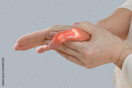 무지(엄지)중수지관절측부인대손상(Gamekeeper's thumb)_ 엄지손가락 통증